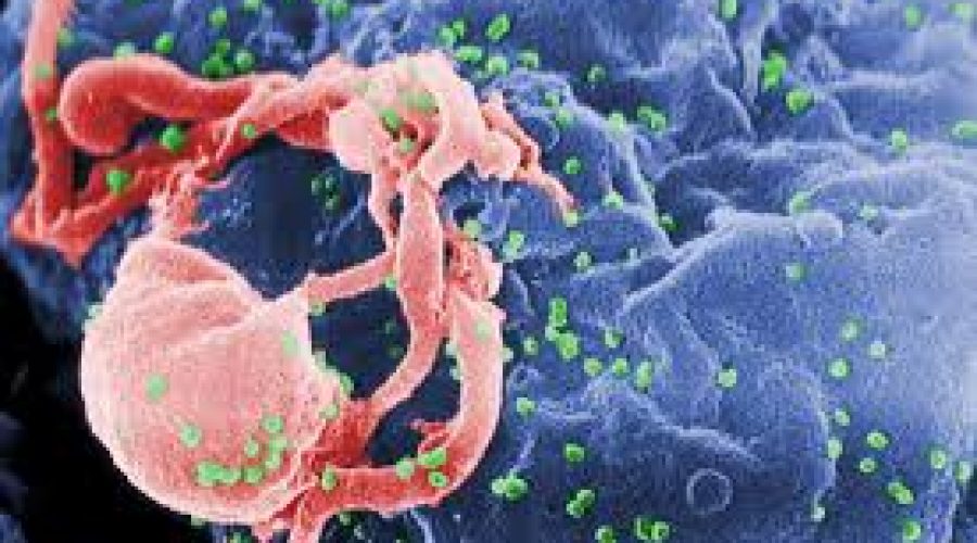 Ανακάλυψαν νέο στέλεχος του ιού HIV-1 στην Κύπρο